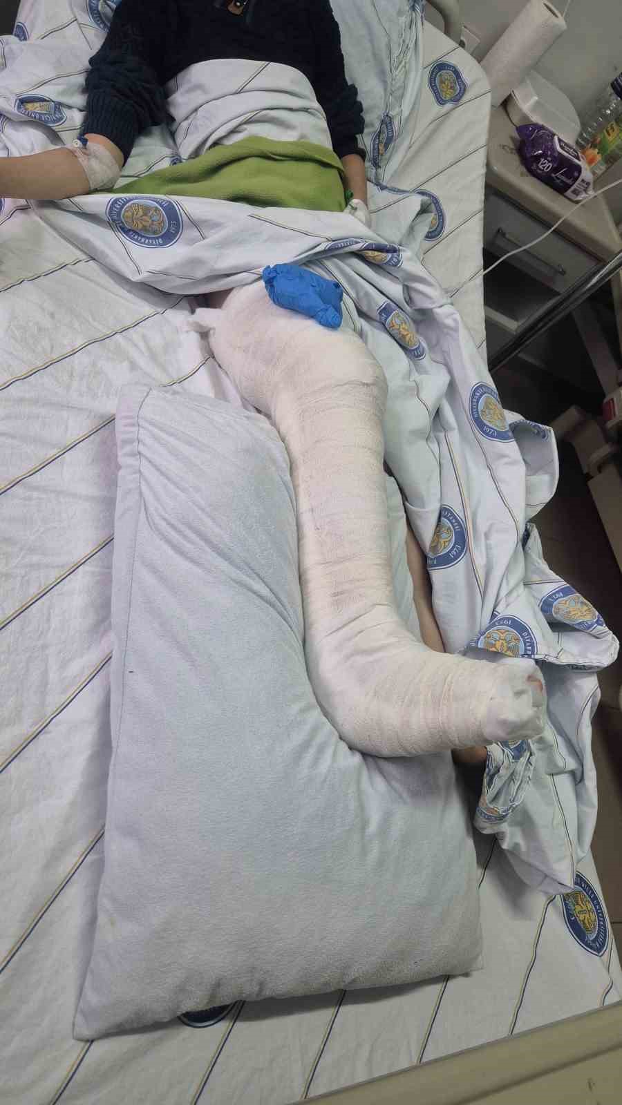 Diyarbakır&rsquo;da k&ouml;peklerden ka&ccedil;an &ccedil;ocuğun bacağı kırıldı
