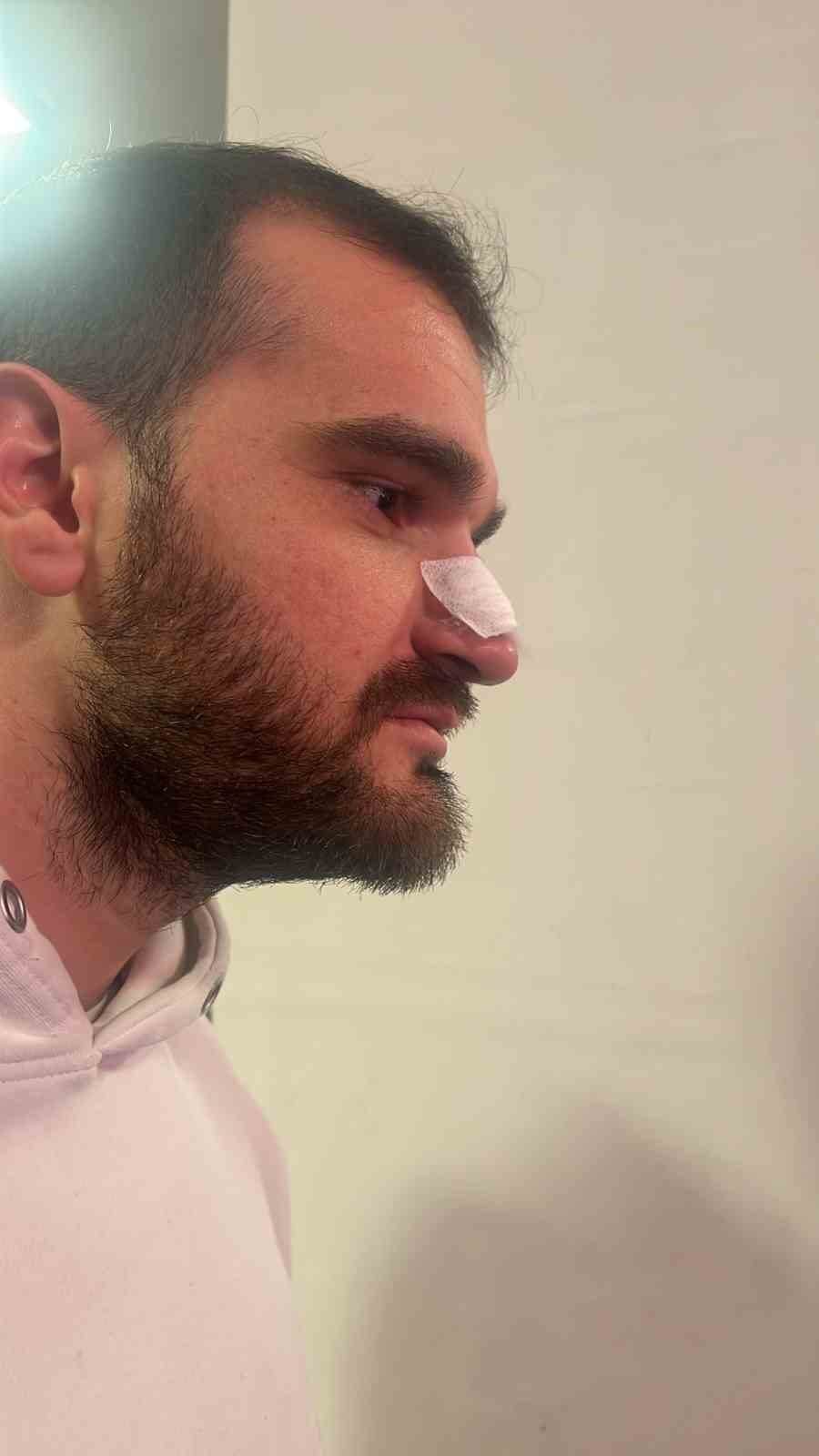 Yeşil saha boks ringine d&ouml;nd&uuml;
