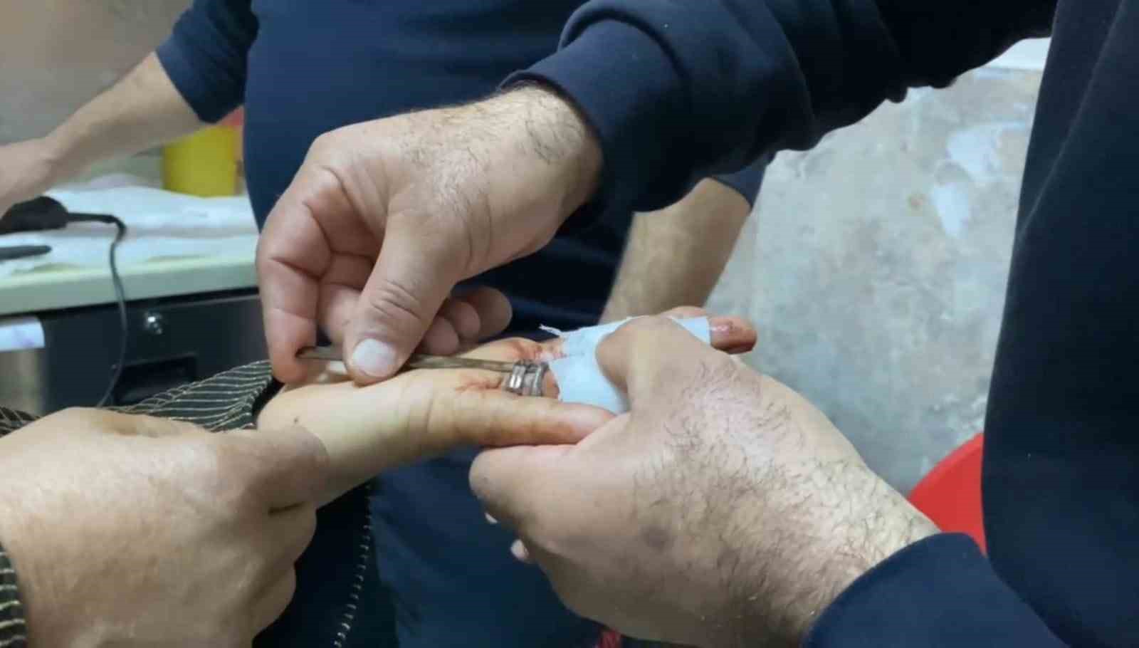 İtfaiyeden yüzük operasyonu