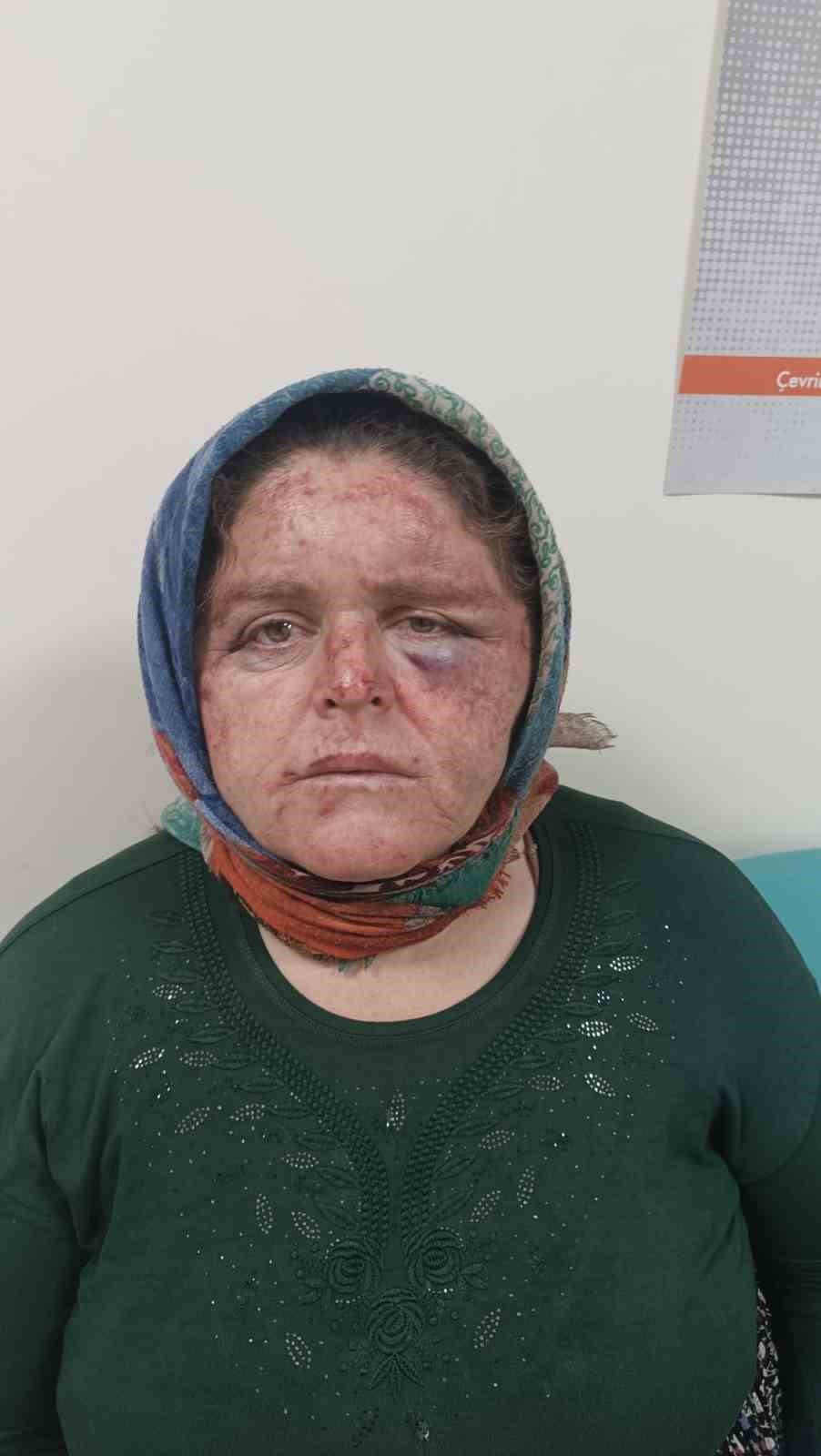 Madde bağımlısı oğlunun şiddetine maruz kalan anne, yaşadığı dehşeti anlattı
