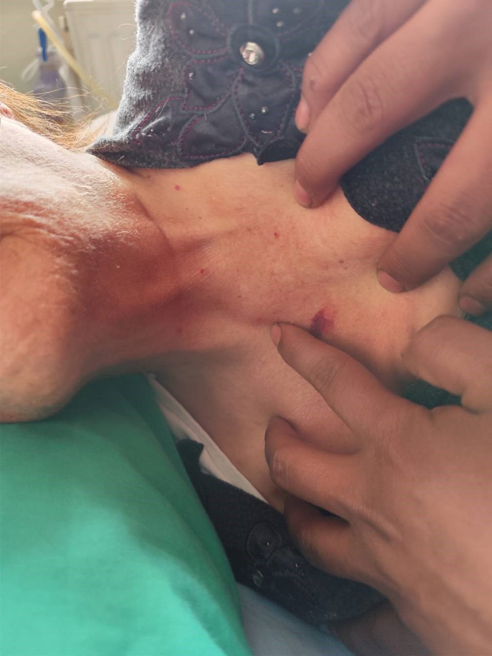 Gaziantep’te özel hastanenin yoğun bakım ünitesinde şiddet iddiası