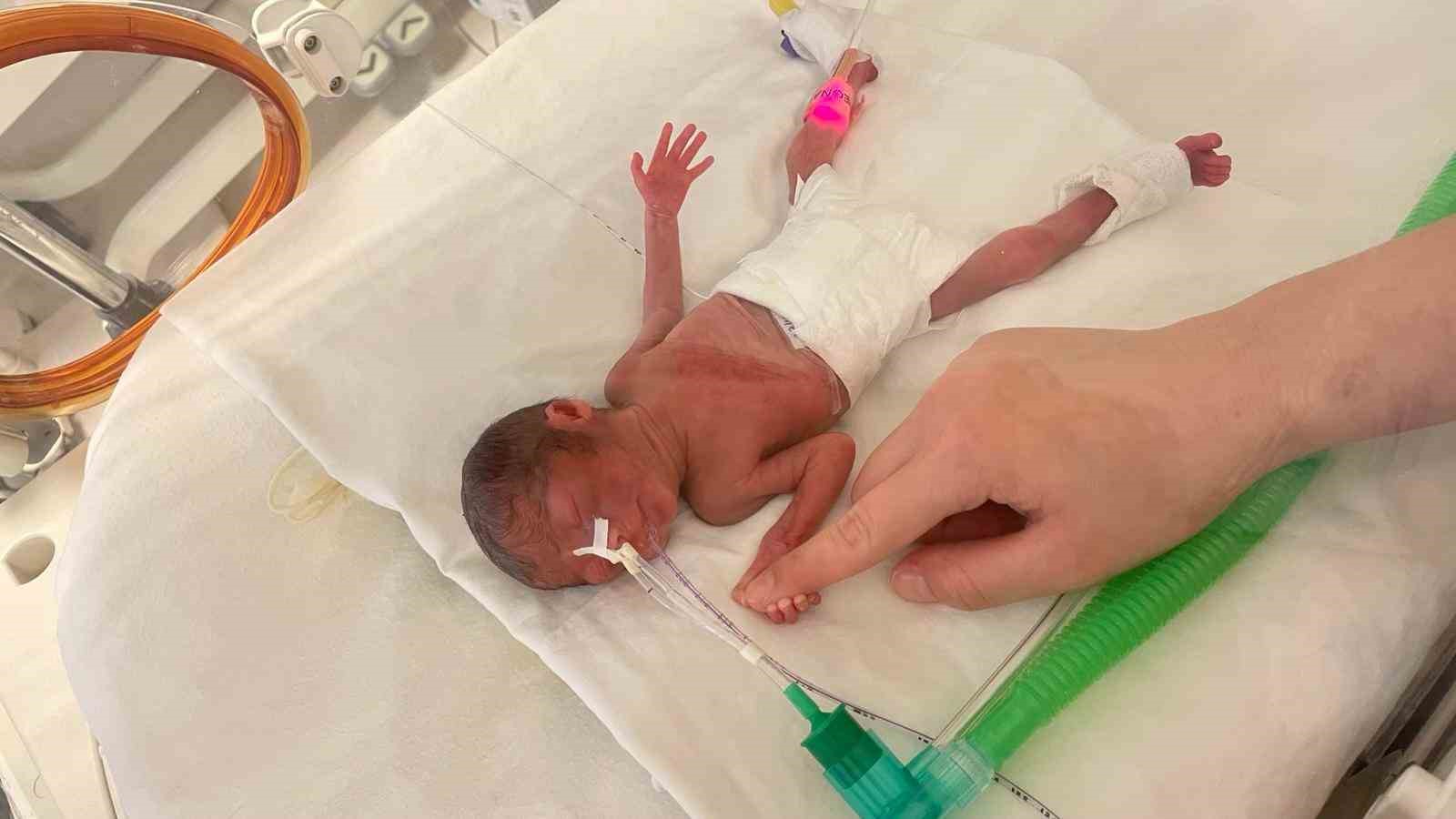 400 gram doğan Aylin bebek hayata tutundu