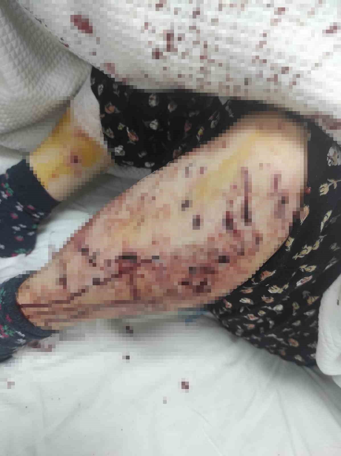 Başıboş köpekler 66 yaşındaki kadını yaraladı
