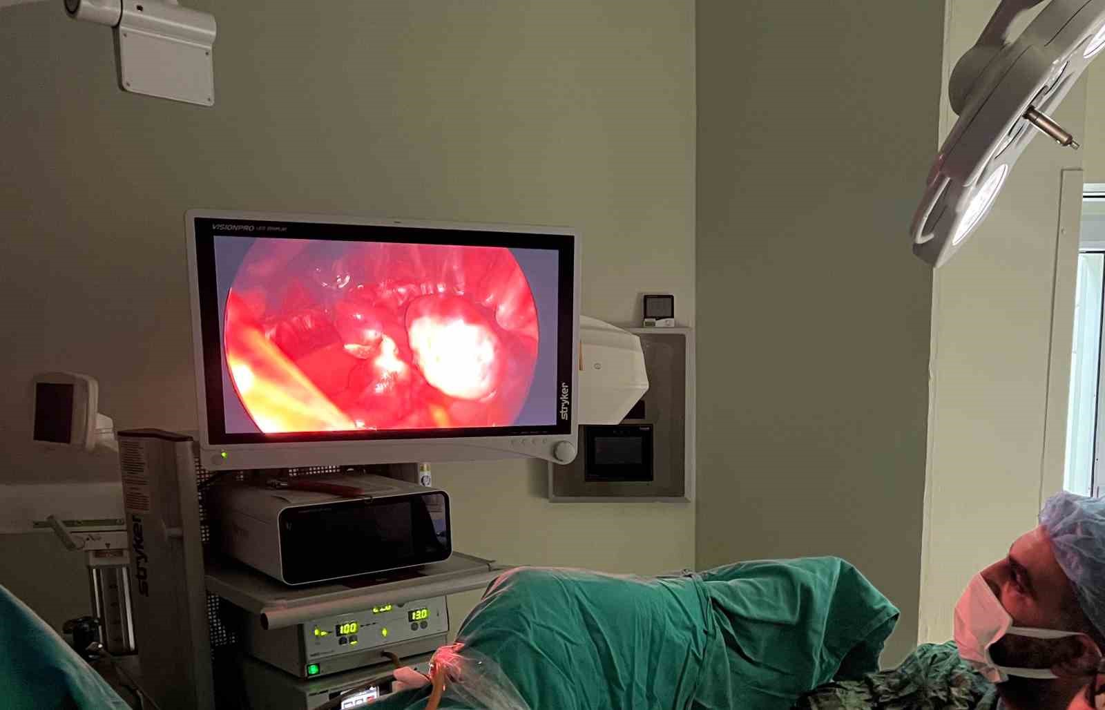 Şırnak&rsquo;ta hastalar V-NOTES Histerektomi ameliyatı ile daha hızlı iyileşiyor
