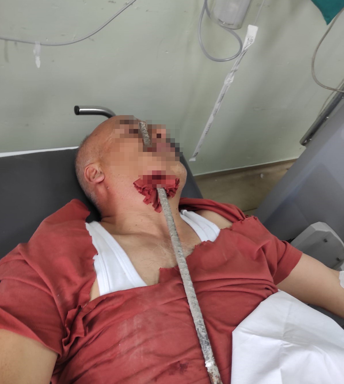 İnşaat işçisinin yüzüne demir saplandı