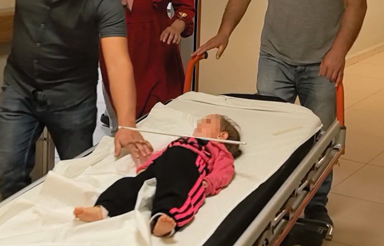 2 yaşındaki &ccedil;ocuğun &ccedil;enesine askı saplandı
