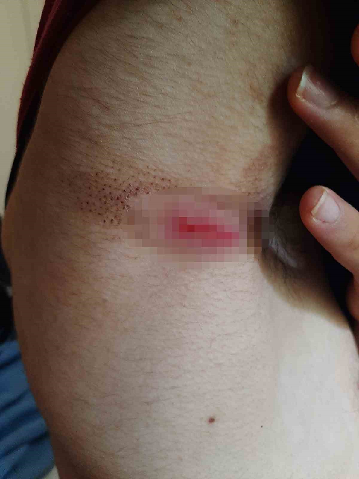 Otizmli gen&ccedil; bakımevinde ila&ccedil; zehirlenmesiyle &ouml;ld&uuml;
