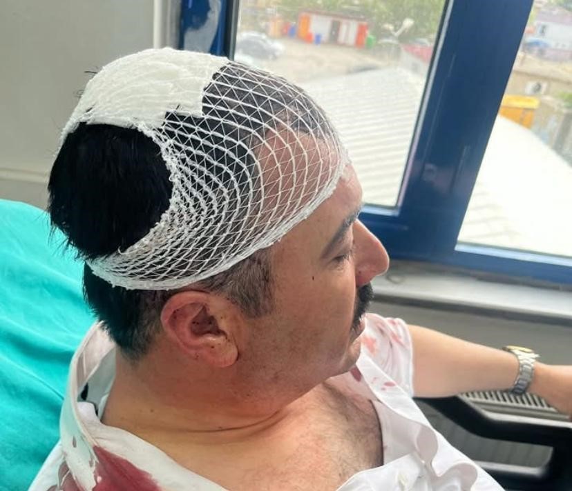 Yeniden Refah Partili Başkan Yardımcısı, belediye başkan yardımcısının kafasına şekerlikle vurdu