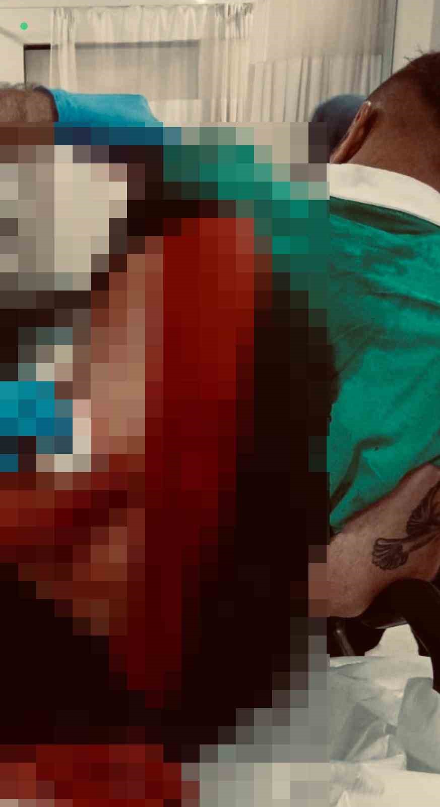 Tartıştığı arkadaşını bı&ccedil;akla yaraladı
