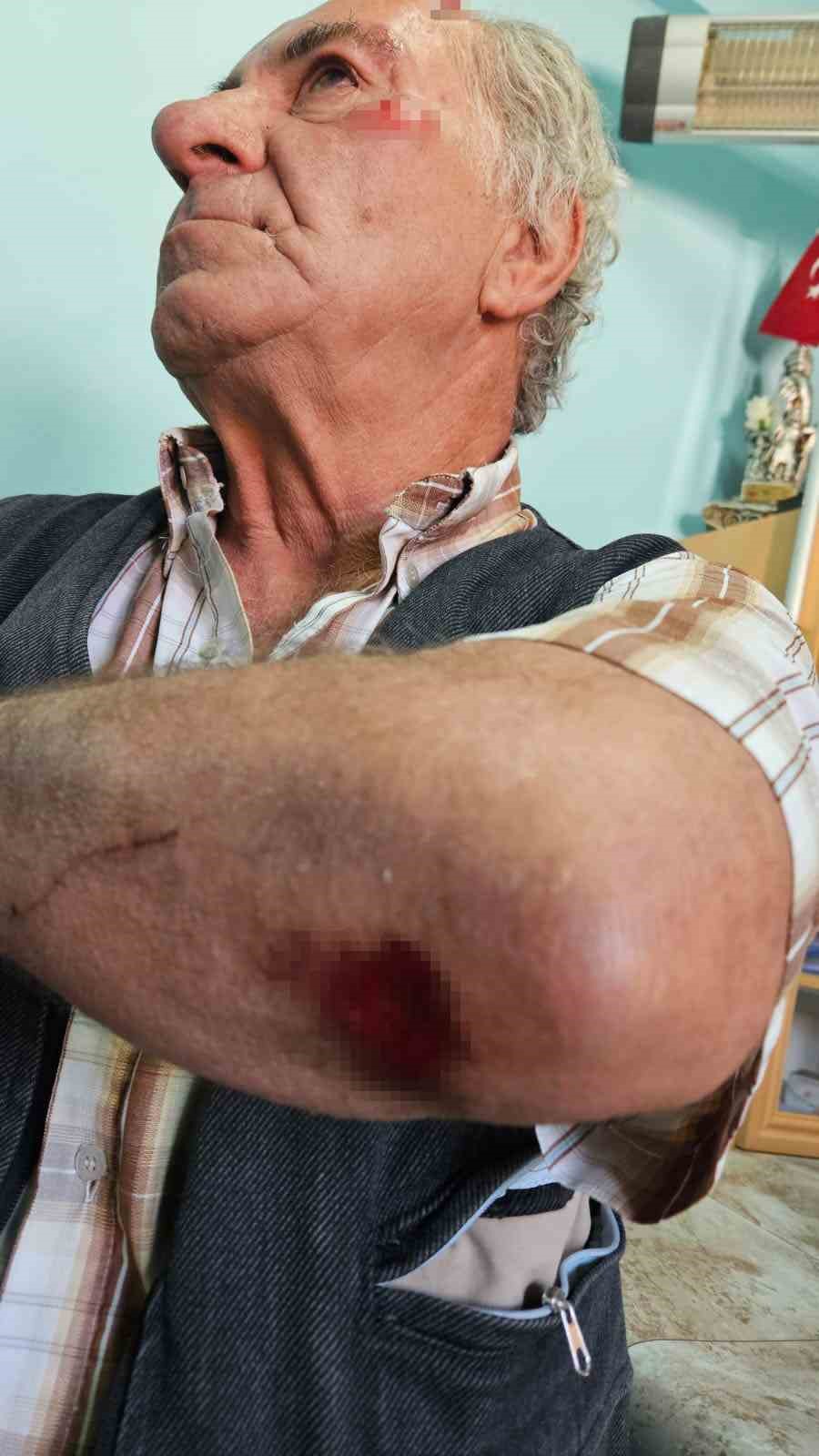 Salda’da köpeklerin saldırısına uğrayan yaşlı adam yaralandı