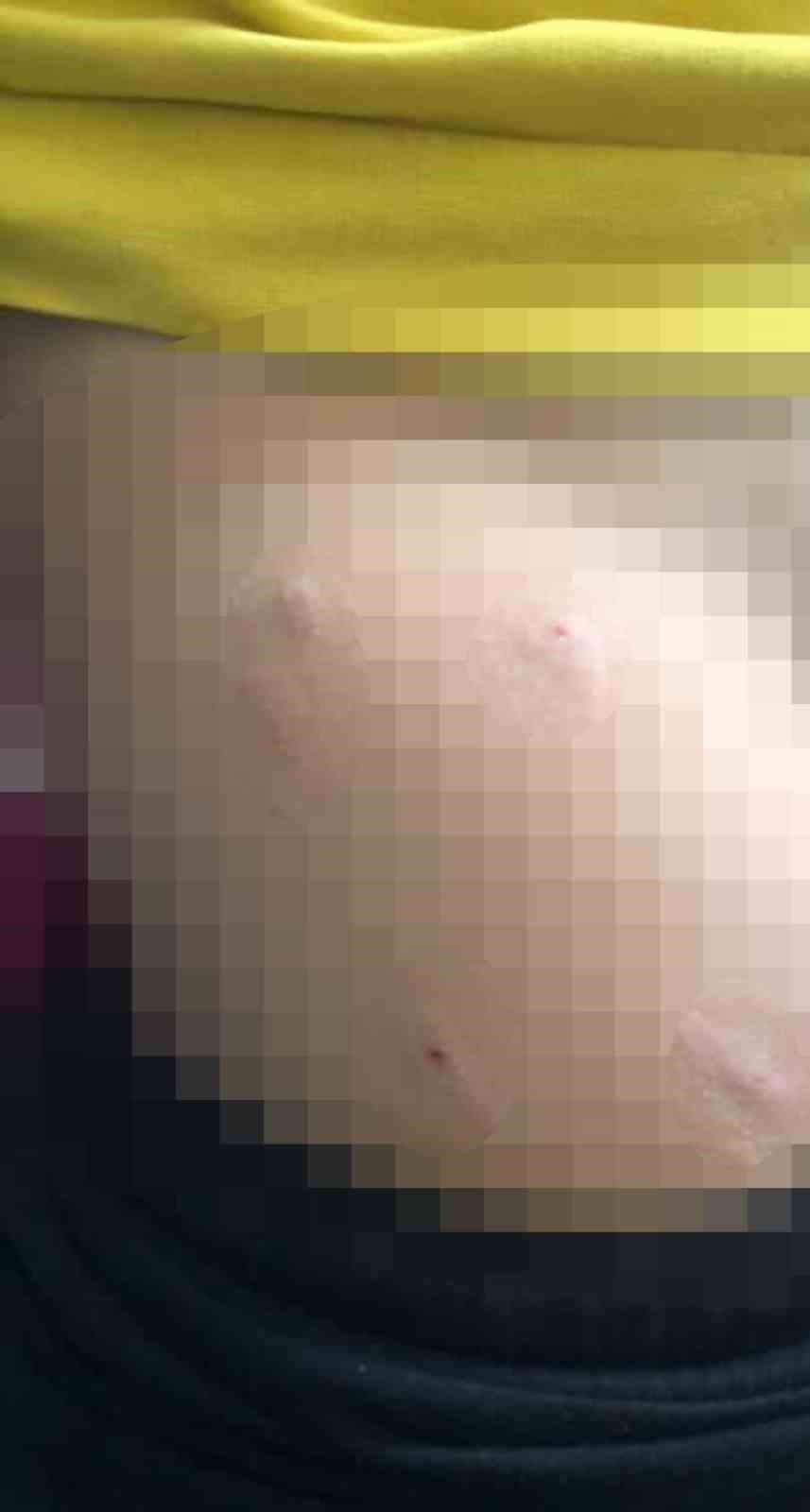 Sokak k&ouml;peği 5 yaşındaki &ccedil;ocuğa saldırdı
