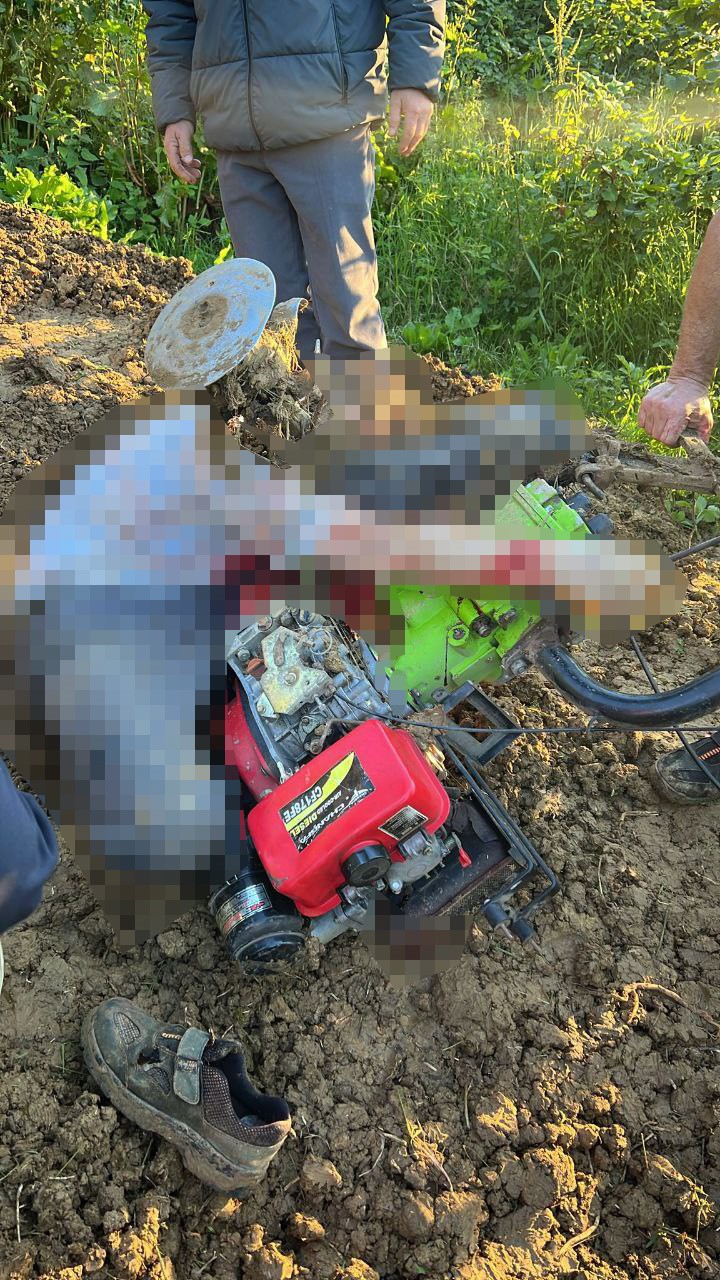 Pat pata ayağını kaptıran şahıs hayatını kaybetti