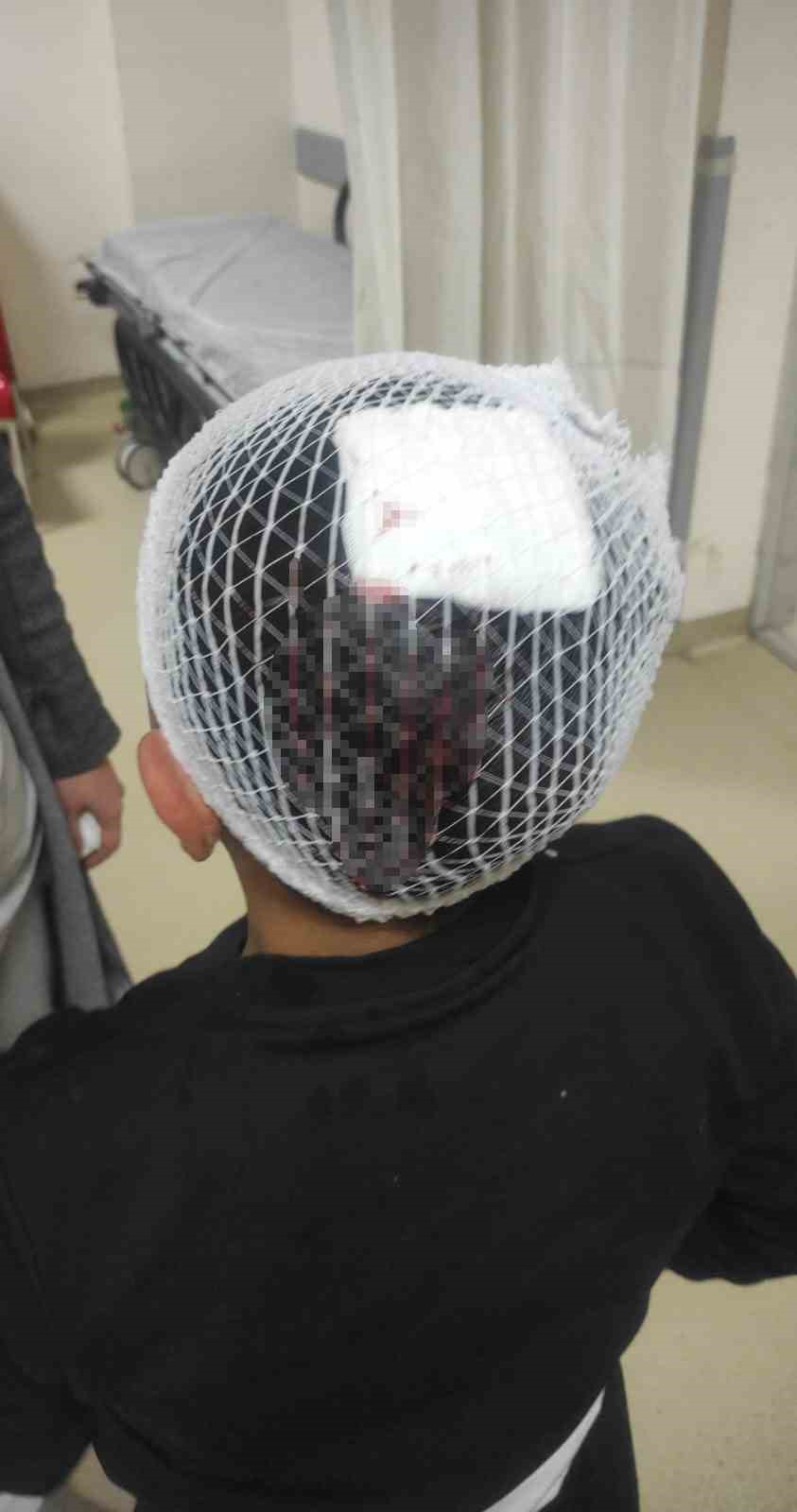 Şampiyonluk kutlamasında havai fişek 9 yaşındaki &ccedil;ocuğun kafasına isabet etti
