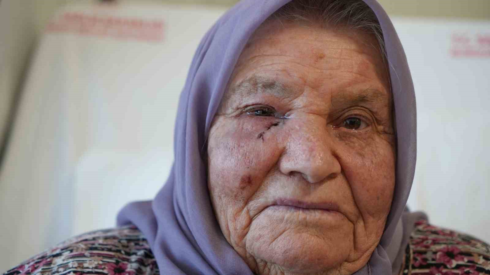 Dört mevsim gözyaşı yağmuru, bir cerrahiyle güneşle buluştu