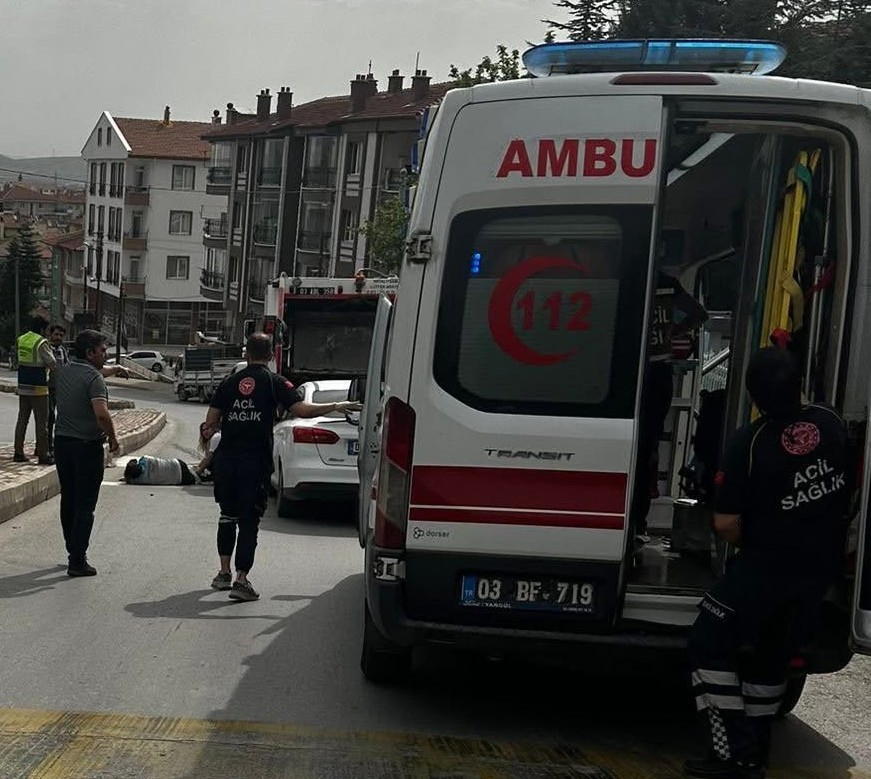 Otomobil temizlik işçisinin ayağını kopardı