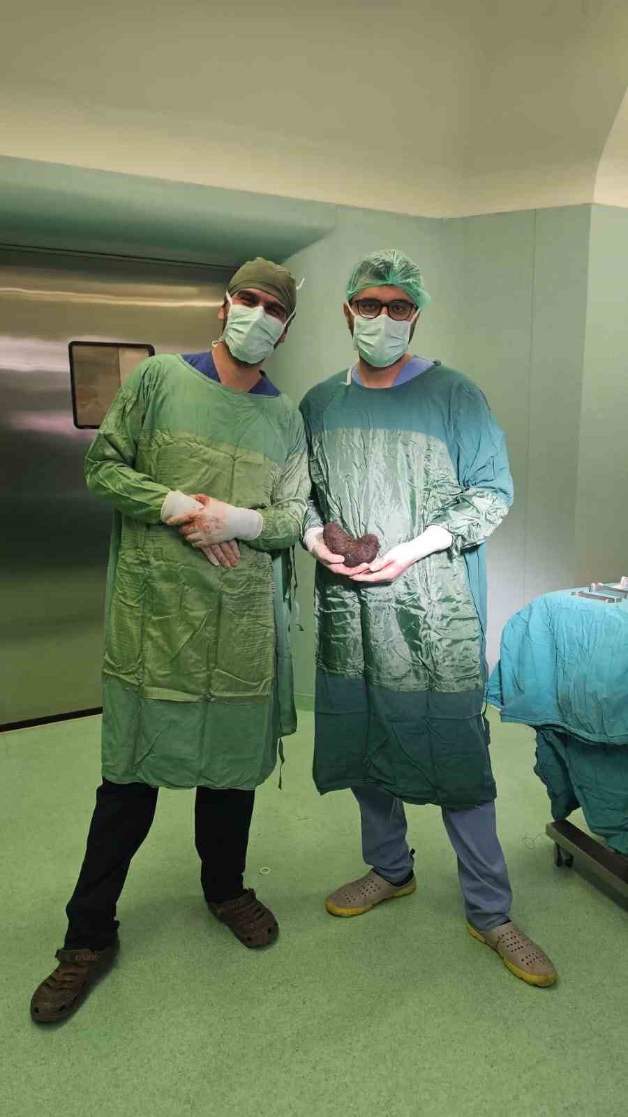 Minik kızın midesinden devasa bir sa&ccedil; yumağı &ccedil;ıktı
