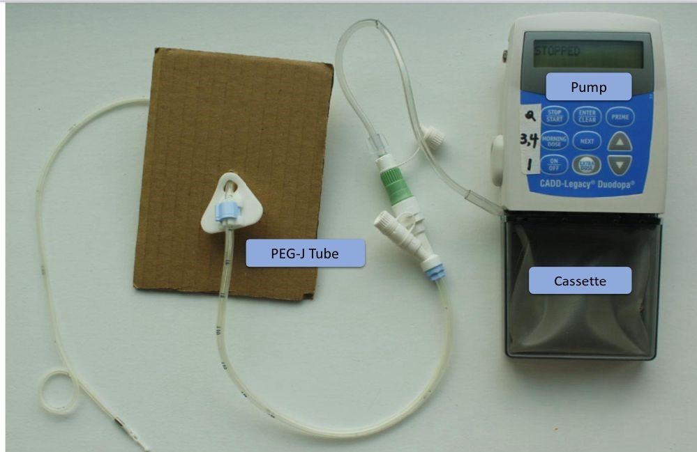 Günde kullandığı 12 ilaçtan tek tedaviyle kurtuldu