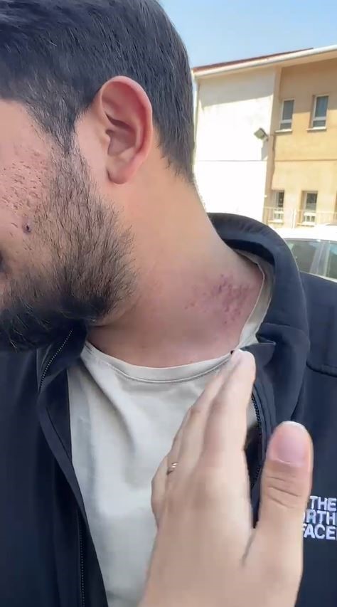 G&uuml;ng&ouml;ren&rsquo;de iş yerinde yaşanan patlama sonrası gazetecilere saldırı
