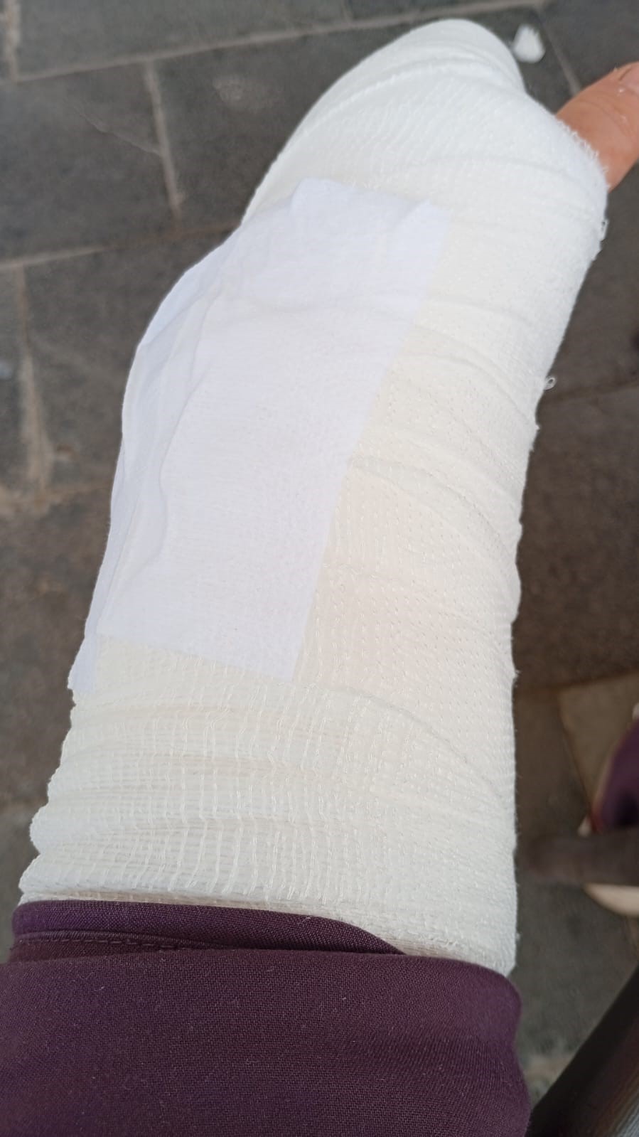 İşe giden kadına &ccedil;arpıp ka&ccedil;tı, plakası ve tamponu olay yerinde kaldı
