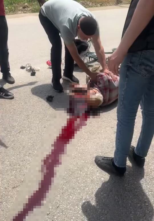 Motosiklet ile &ccedil;arpışan bisiklet s&uuml;r&uuml;c&uuml;s&uuml; hayatını kaybetti
