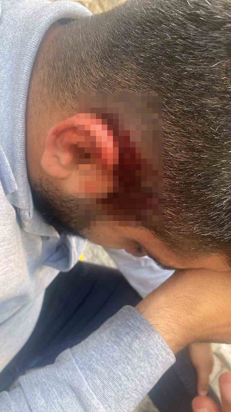 Elektrik personeli saldırıya uğradı, ka&ccedil;ak trafo &ouml;l&uuml;m getirdi
