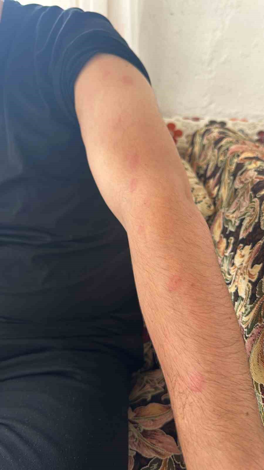 Yozgat&rsquo;ı etkisi altına alan dolu, bazı b&ouml;lgeleri beyaza b&uuml;r&uuml;d&uuml;
