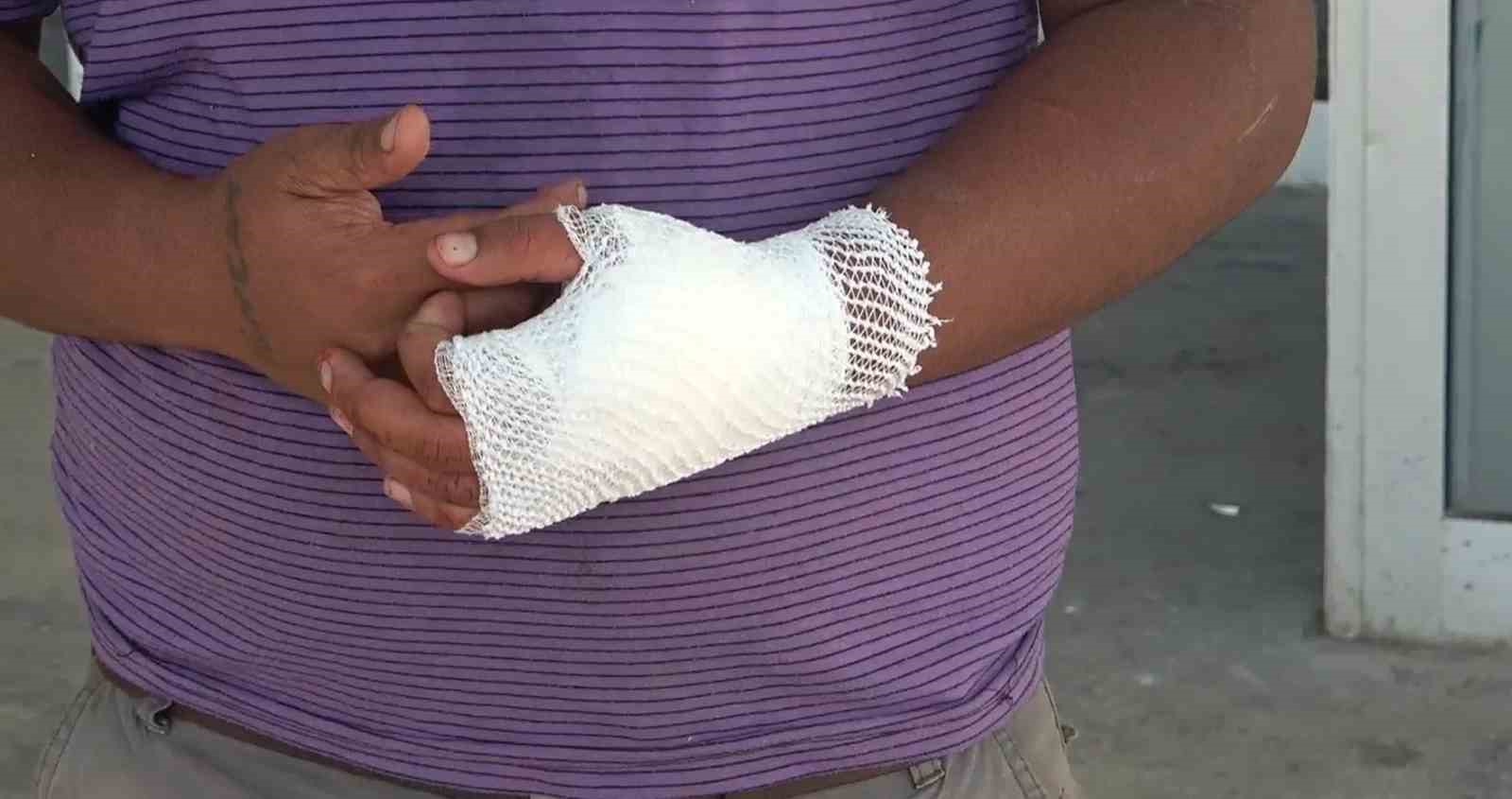 Adana&rsquo;da acemi kasaplar hastanelere başvurdu