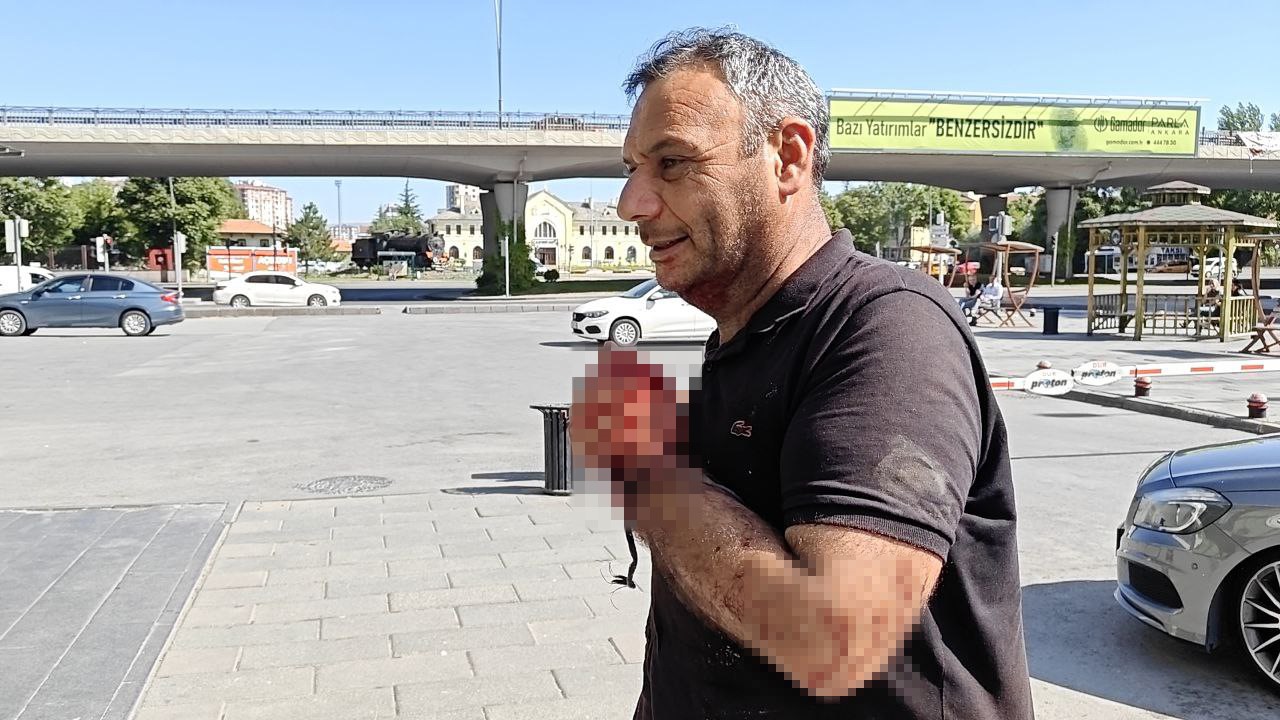 Kayseri’de acemi kasaplar soluğu acil serviste aldı