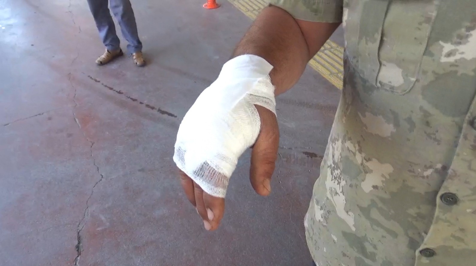 Şanlıurfa’da 176 acemi kasap hastanelik oldu