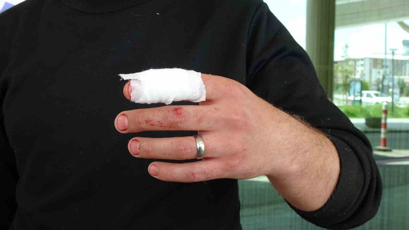 Acemi kasaplar acil servilerde yoğunluk oluşturdu