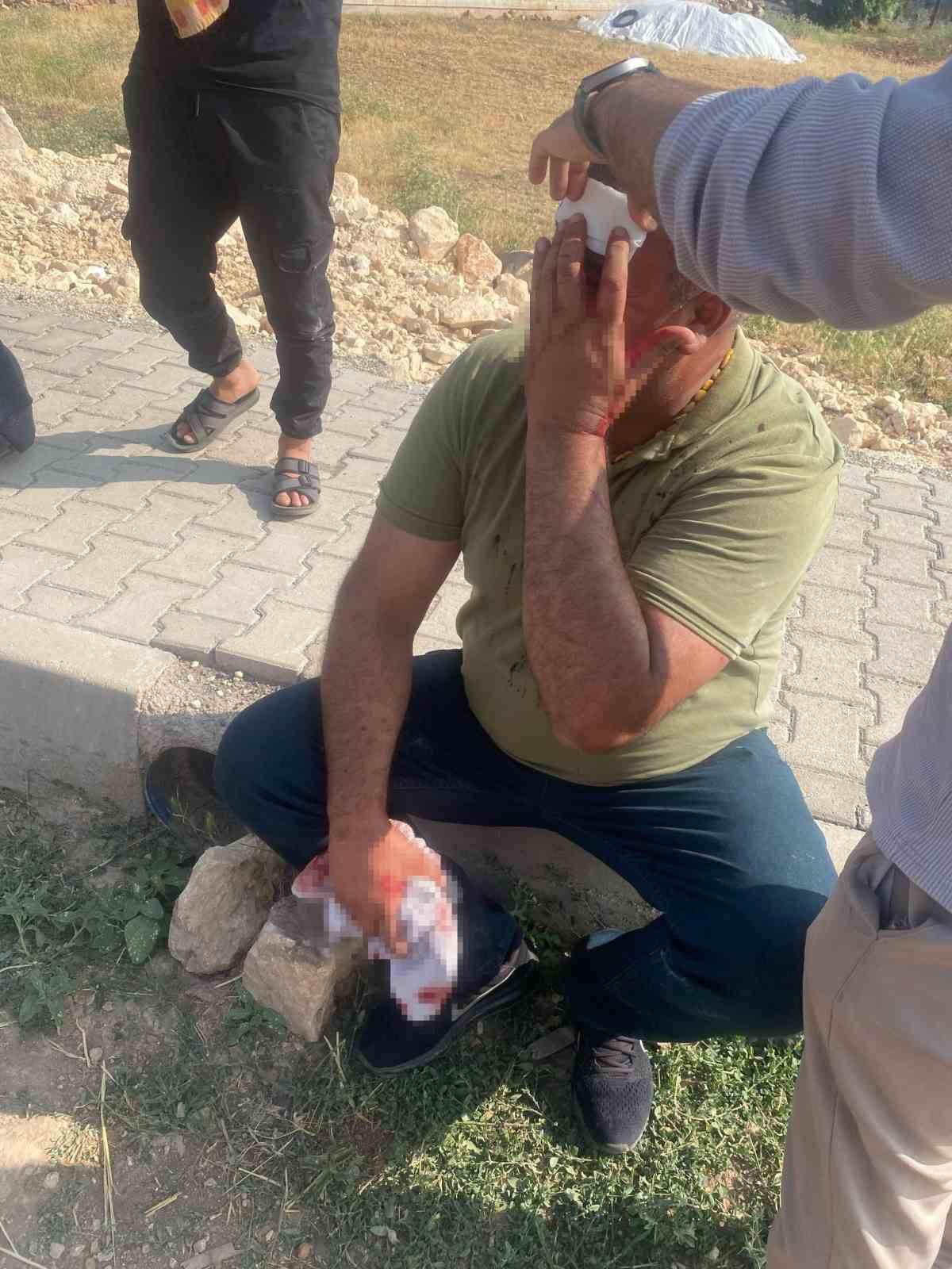 Şanlıurfa&rsquo;da &ccedil;ocukların kavgasına b&uuml;y&uuml;kler karıştı: 5 yaralı
