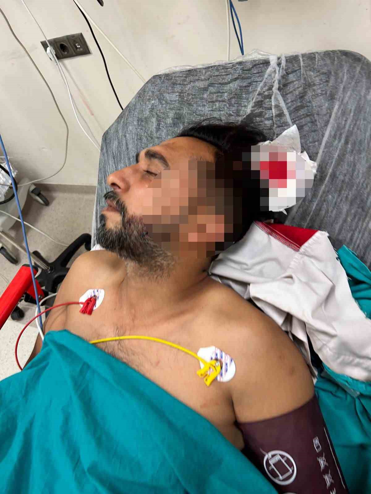 Adana’da döner ustası çalışırken başından yorgun mermiyle yaralandı