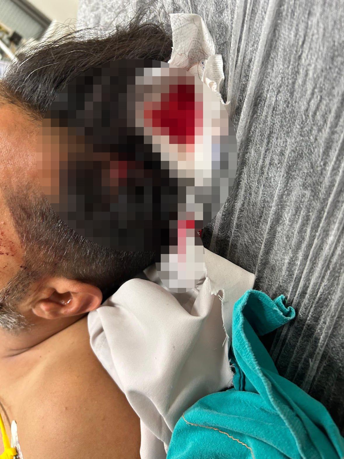 Adana&rsquo;da d&ouml;ner ustası &ccedil;alışırken başından yorgun mermiyle yaralandı
