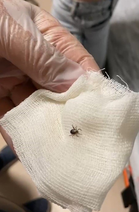 Eskişehir’de kene paniği hastanede bitti
