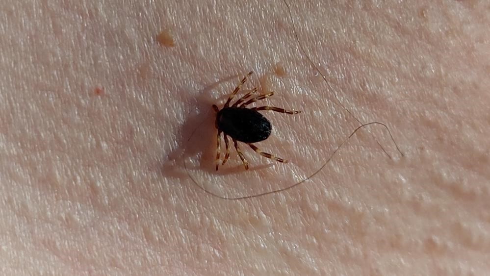 Doğu Karadeniz’de kene mevsimi sakin geçiyor