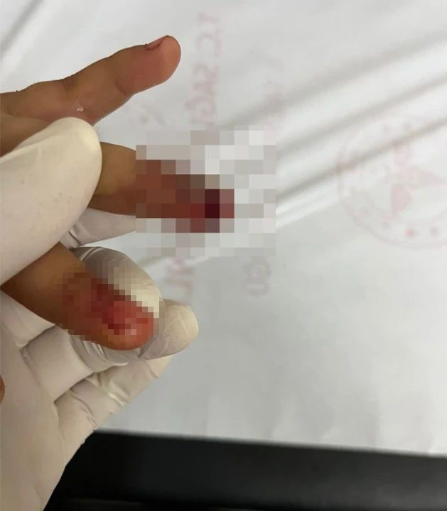 Siirt&rsquo;te 7 yaşındaki &ccedil;ocuk, parmağını parktaki spor aletine sıkıştırdı
