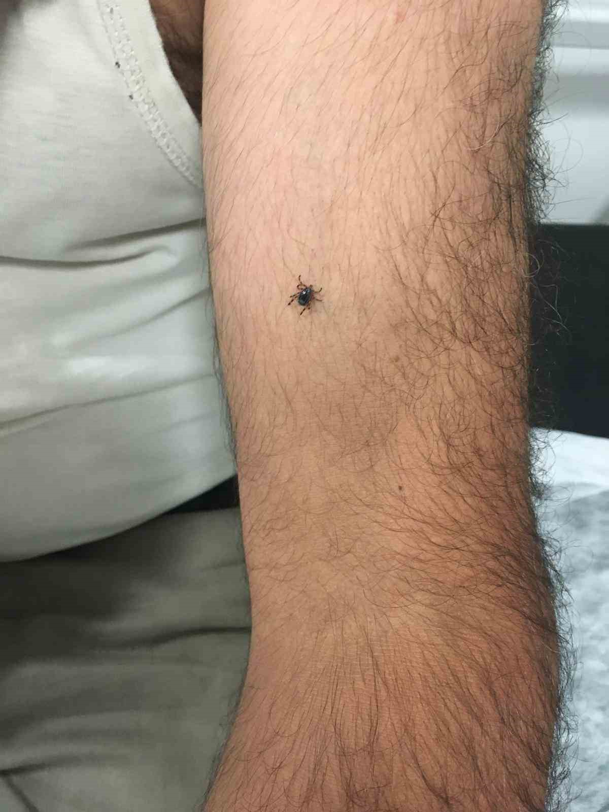 Kayseri’nin bir ilçesinde daha kene vakası