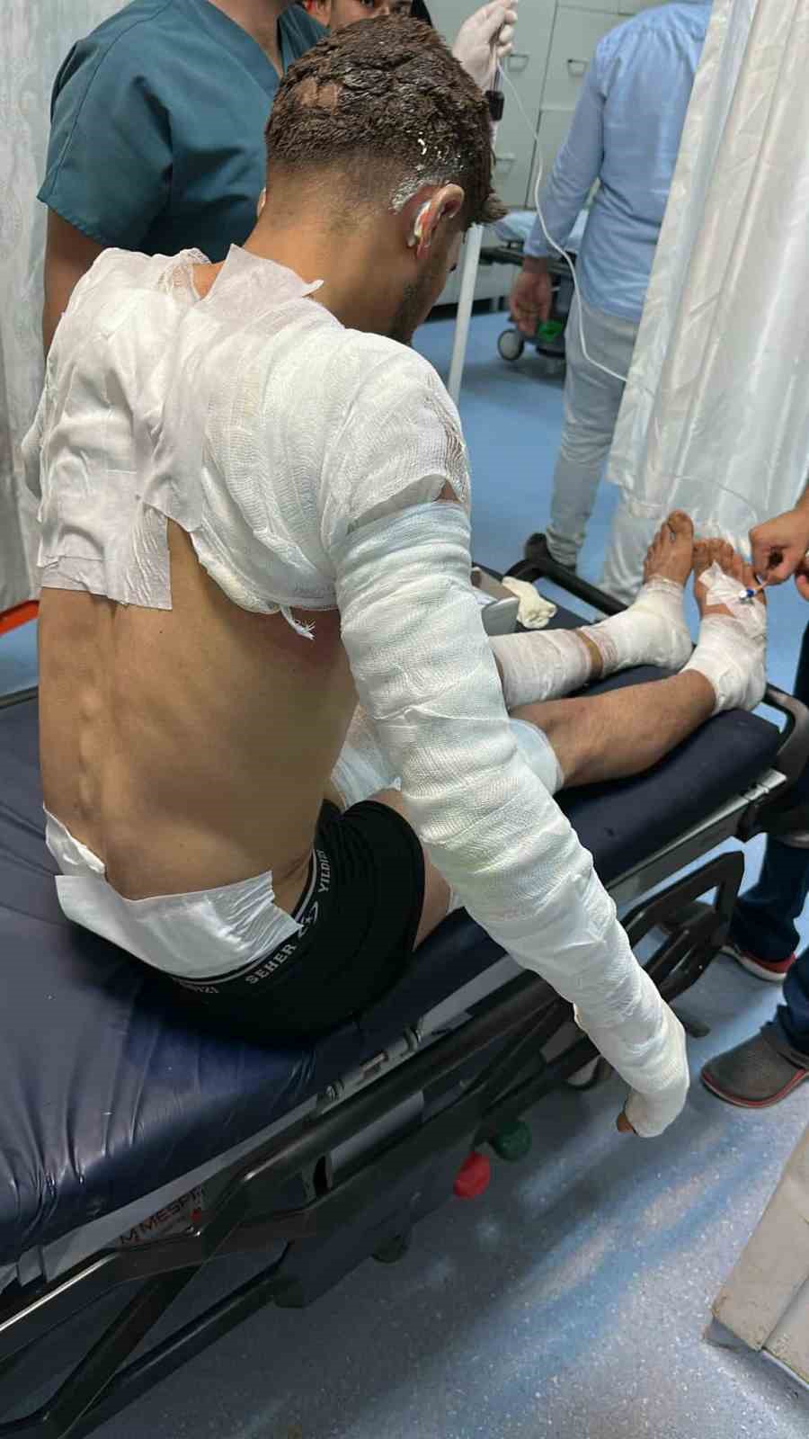 Şanlıurfa&rsquo;da buğday tarlasında yangın: 1&rsquo;i ağır 5 yaralı
