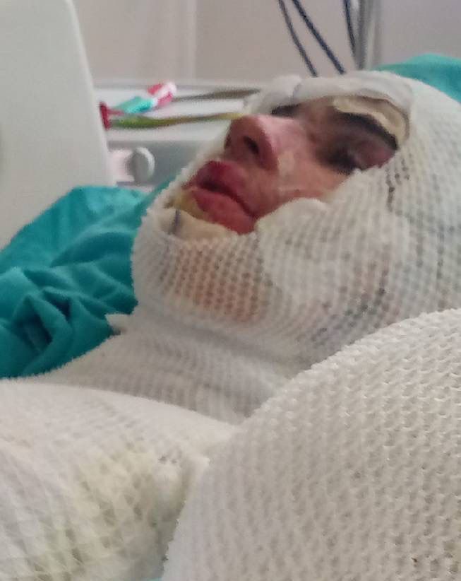Yeğenini yakan amca, suçu ağabeyine attı
