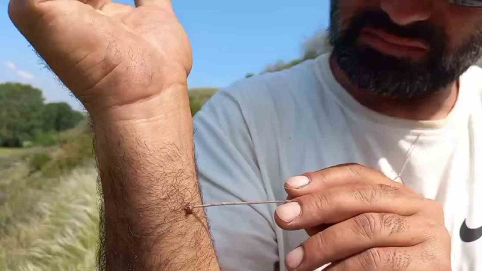 Uzmanı uyardı: "Kenenin vücutta kalma süresi hastalığın bulaşma riskini yükseltiyor"