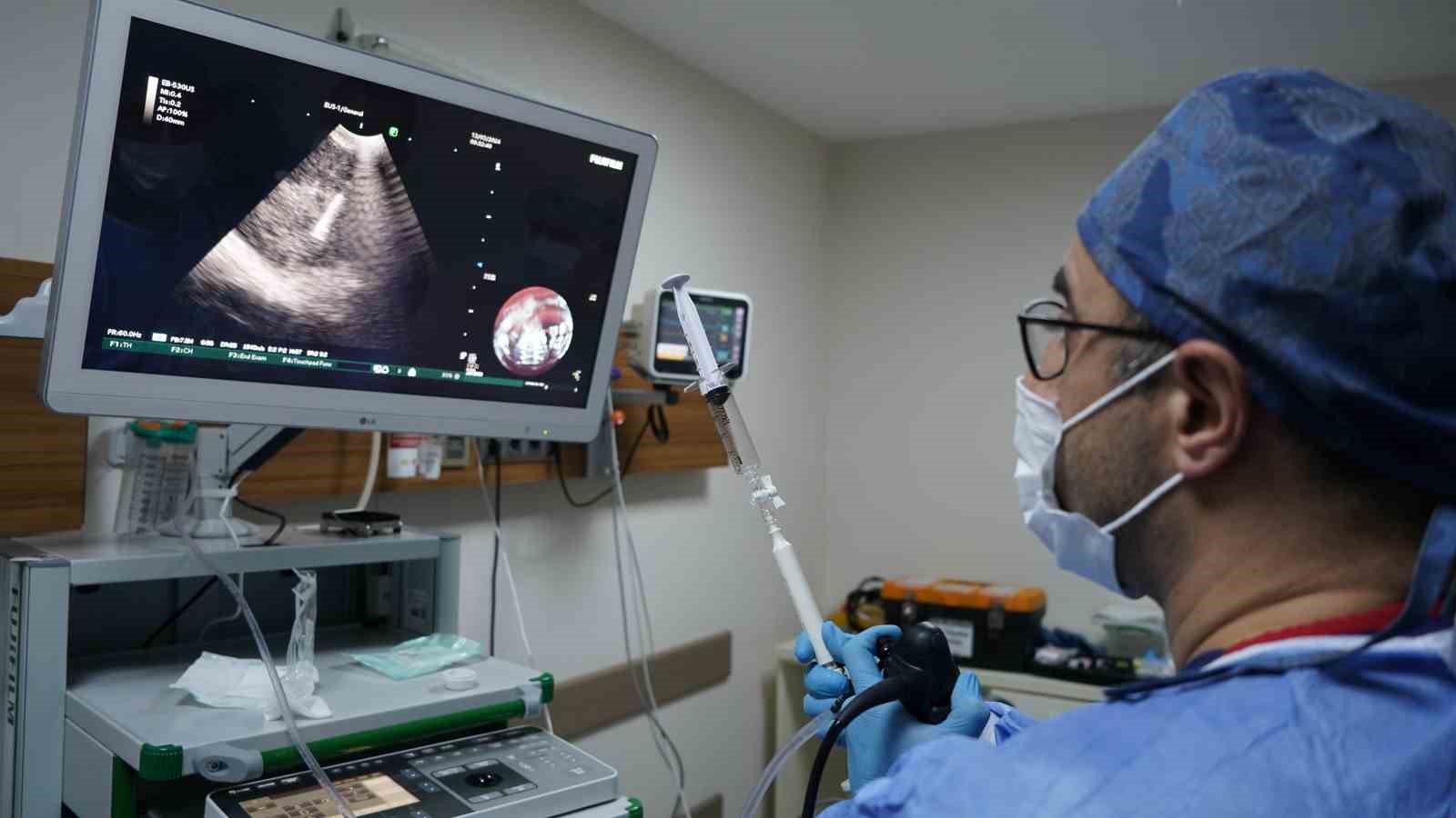 İEÜ Medical Point Hastanesi Akciğer Sağlığı Merkezi’nde EBUS ile ameliyatsız tanı