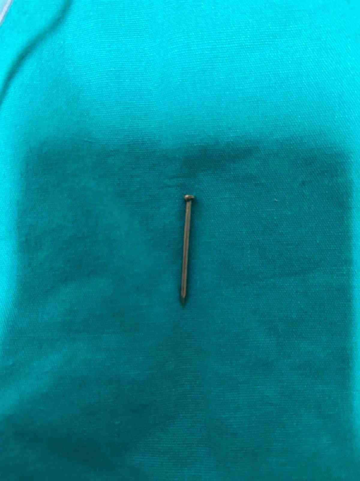 2 yaşındaki &ccedil;ocuğun midesinden 4 santimetrelik &ccedil;ivi &ccedil;ıktı
