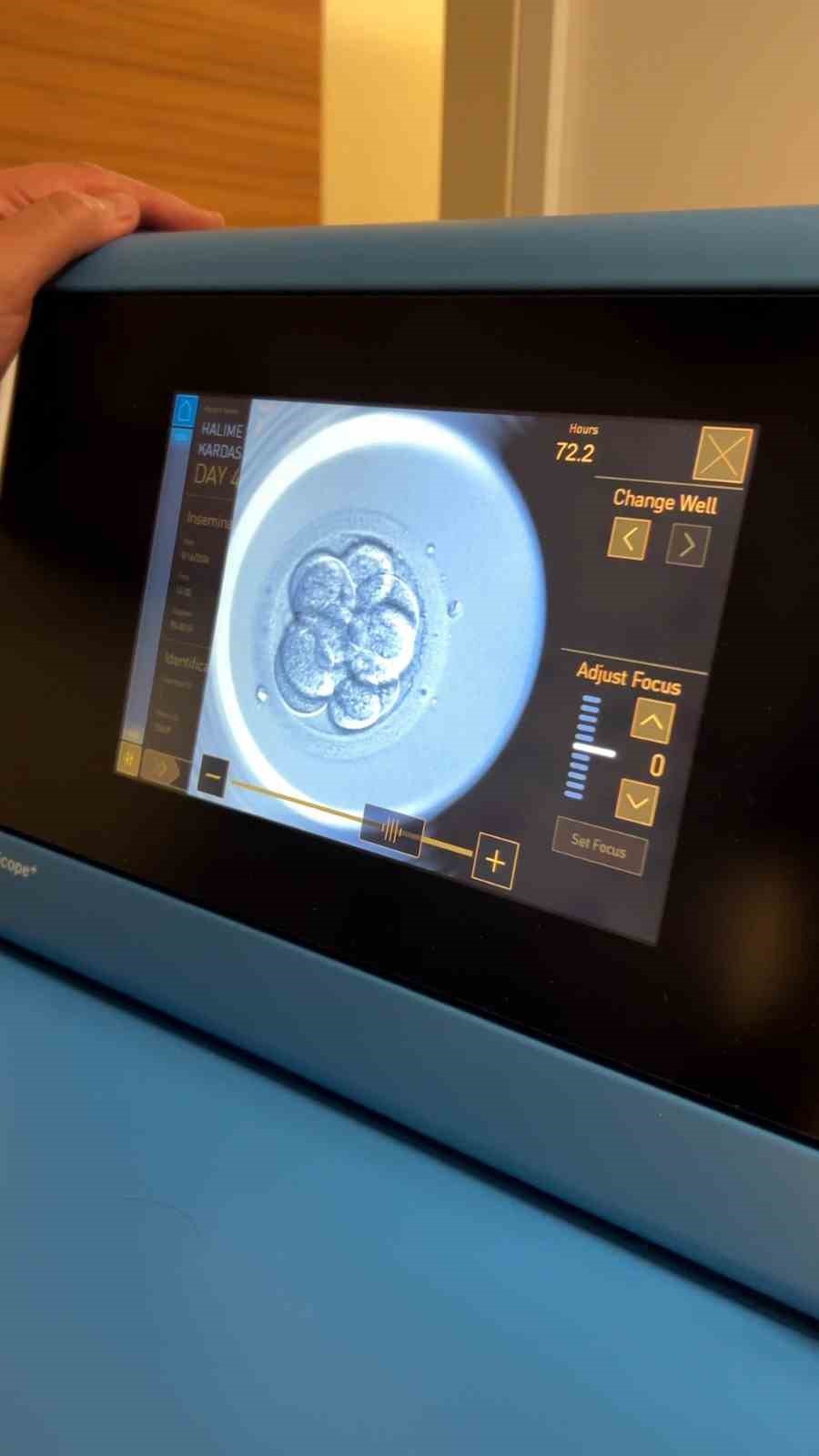 T&uuml;p bebekte yeni d&ouml;nem: Yapay zeka destekli başarı
