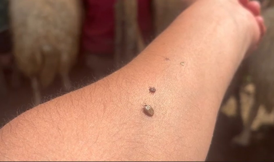 Erzincan’da KKKA uyarısı: Kene temasına karşı dikkatli olun!