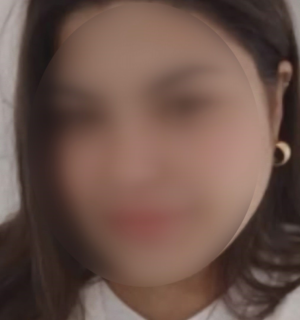 Kazada ağır yaralanan kadın hayatını kaybetti
