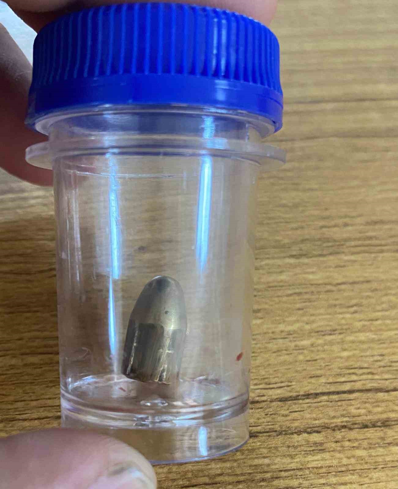 Bah&ccedil;ede oynayan 8 yaşındaki &ccedil;ocuk, yorgun mermi ile yaralandı
