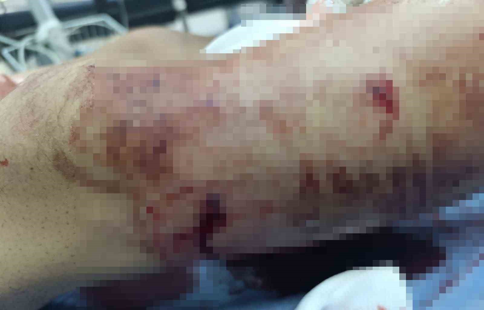 Muş’ta ayının saldırdığı çocuk yaralandı