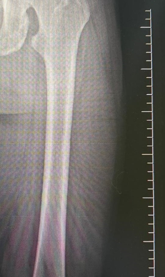 Kısa boy takıntısından Denizli Tekden’de kurtuldu

