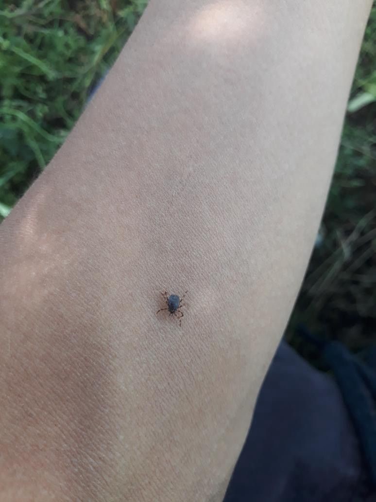 Bolu’da kene ısırması sonucu 77 yaşındaki kadın hayatını kaybetti