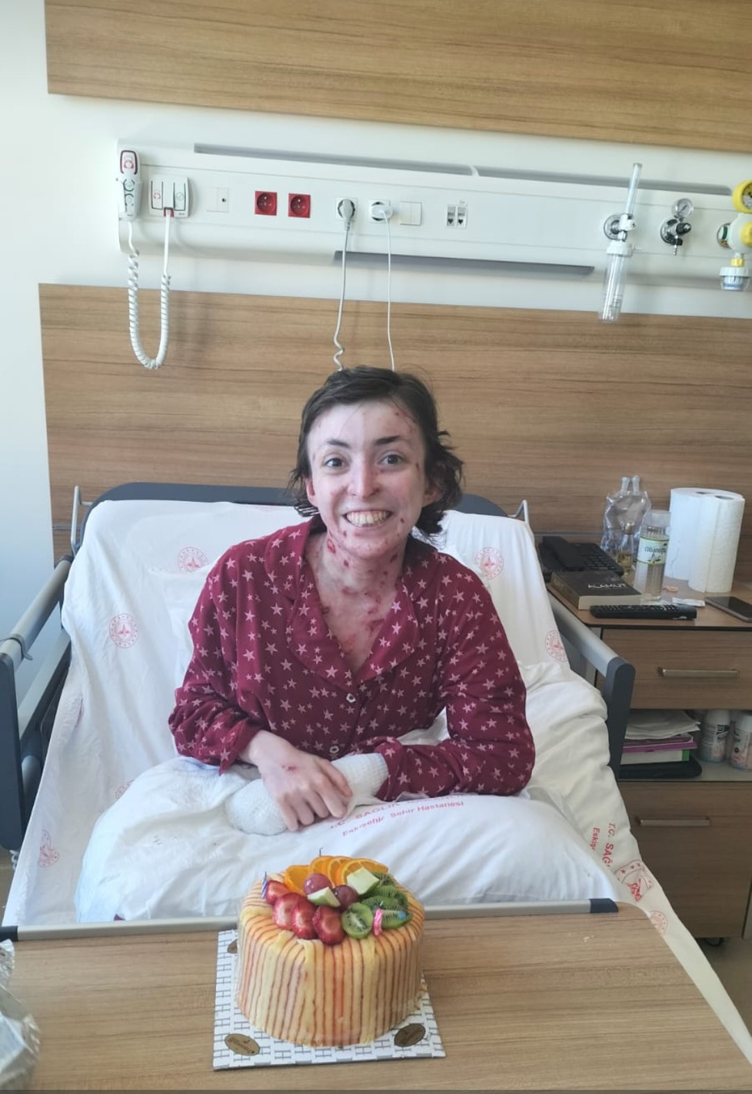 Kelebek hastalığının yanı sıra kanserle de m&uuml;cadele eden Elif kurtarılamadı
